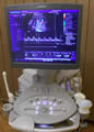 zobacz zdjęcie dotyczące badań prenatalnych w Nieublicznym Zakładzie Opieki Zdrowotnej Centrum Medyczne FEMINA